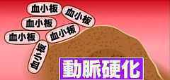 arteriosclerosis_pork.jpg