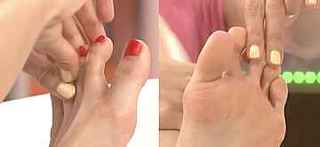 bath_lymph5.jpg