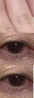 eye_zure1.jpg