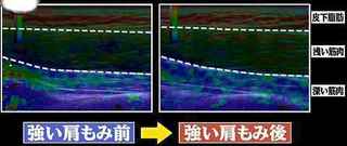 fukai_kinniku_2.jpg