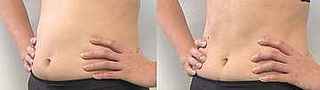 fukushikikokyu_lymph.jpg