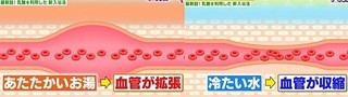 kekkan_kakuchou_shushuku.jpg