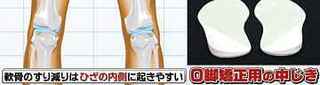 knee_pain_meniscus_bow_legs.jpg