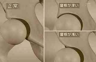 kyugaikeiseifuzen2.jpg